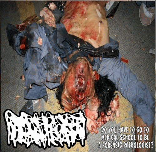 Hydrocephalus : Do You Have to Go to Medical School to Be a Forensic Pathologist? Hydrocephalus : Do You Have to Go to Medical School to Be a Forensic Pathologist?